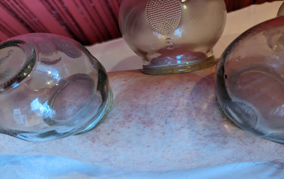 Drainage énergétique chinois